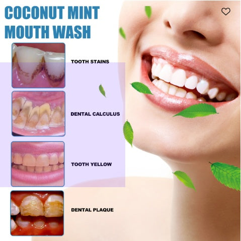 Oralhoe Coconut Mint Mouth Wash, Whitening Teeth Yellow Teeth Stains Tongue Coating Clean  Breath Oral Care